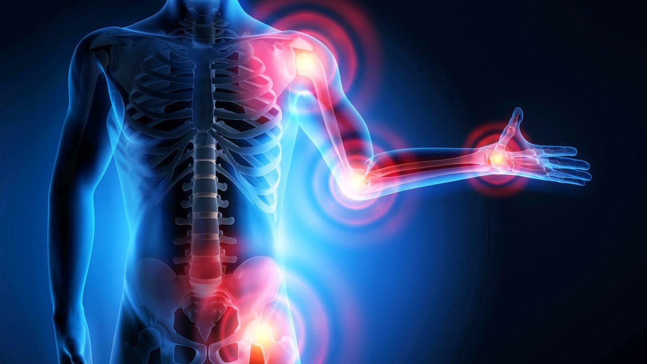 Reduced Joint Stiffness
