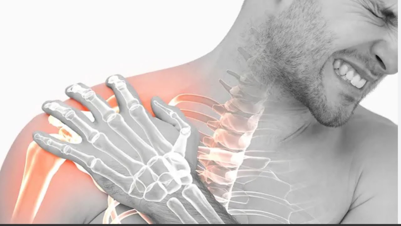 Shoulder Impingement Stretches
