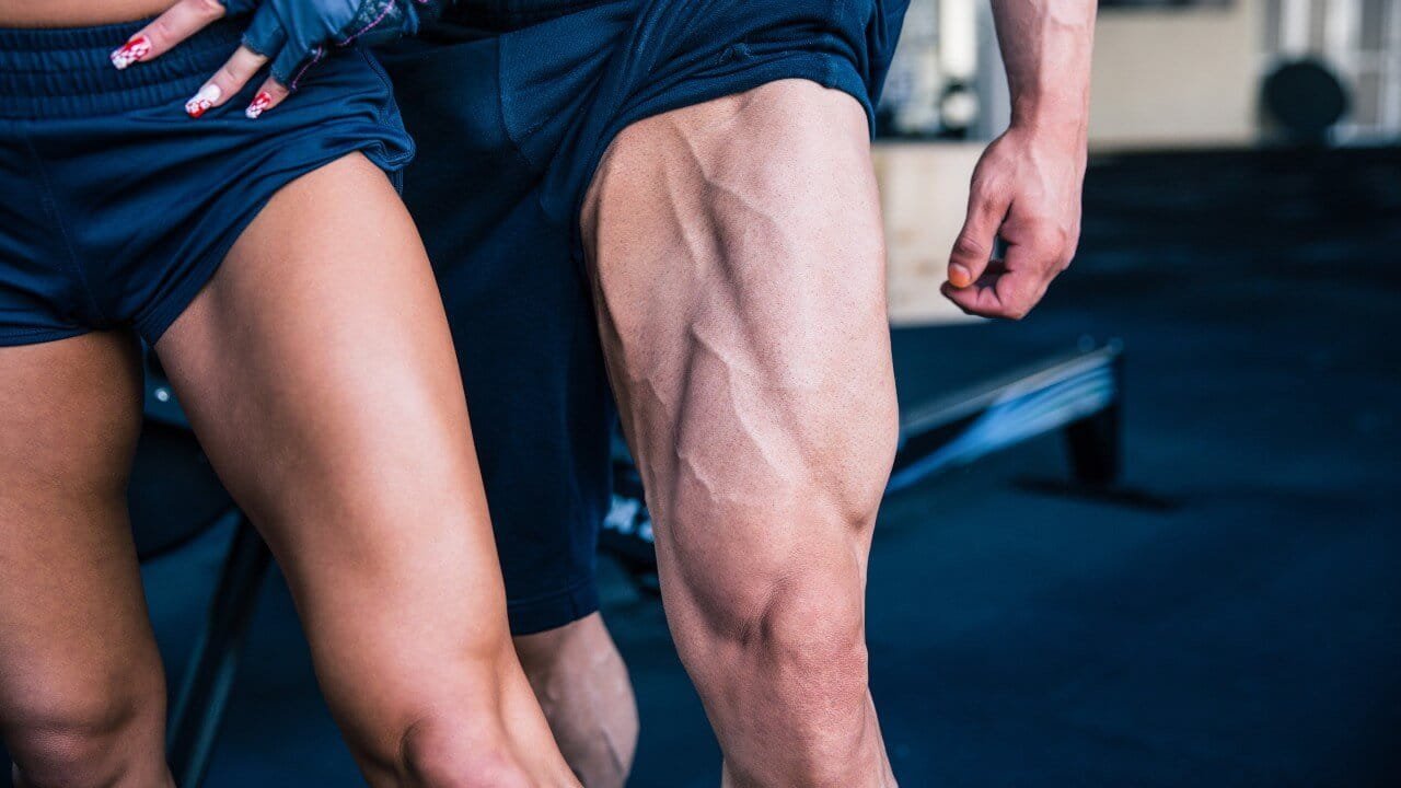 Legs