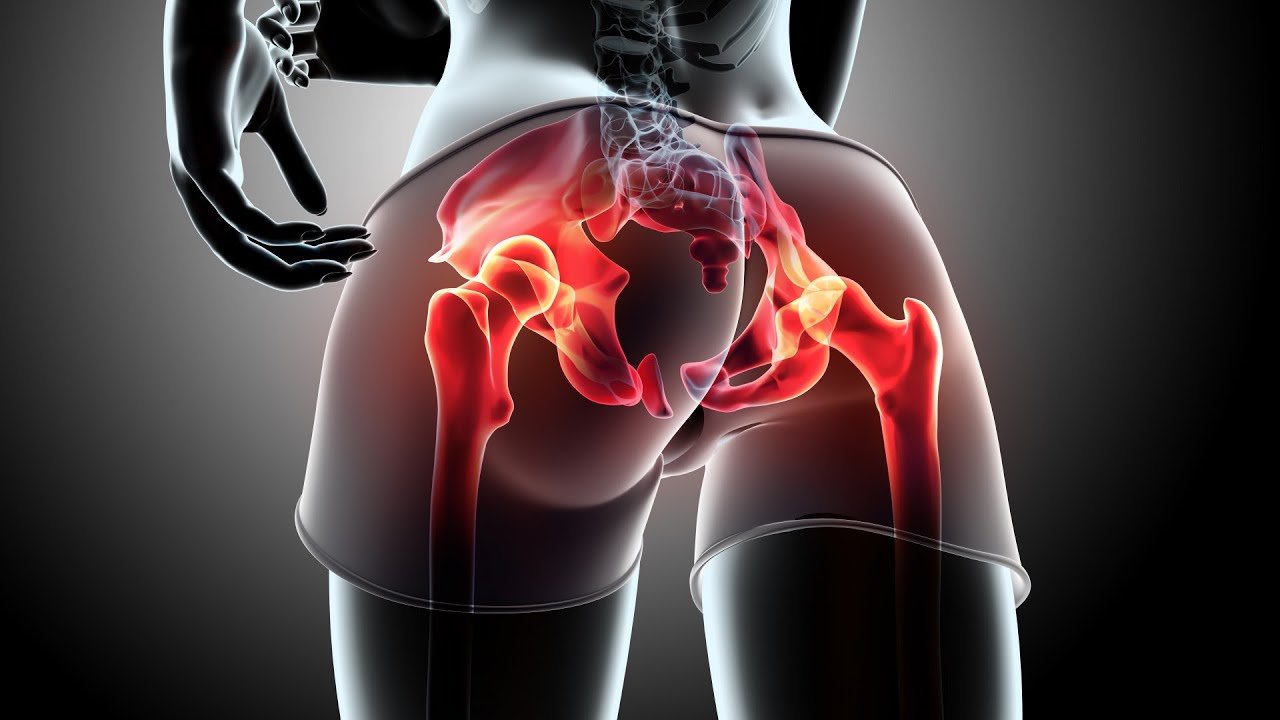 hip impingement exercises