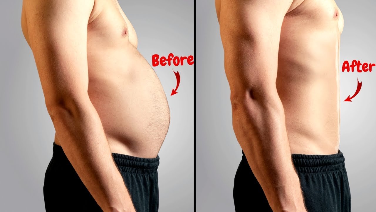 How to Get Semaglutide