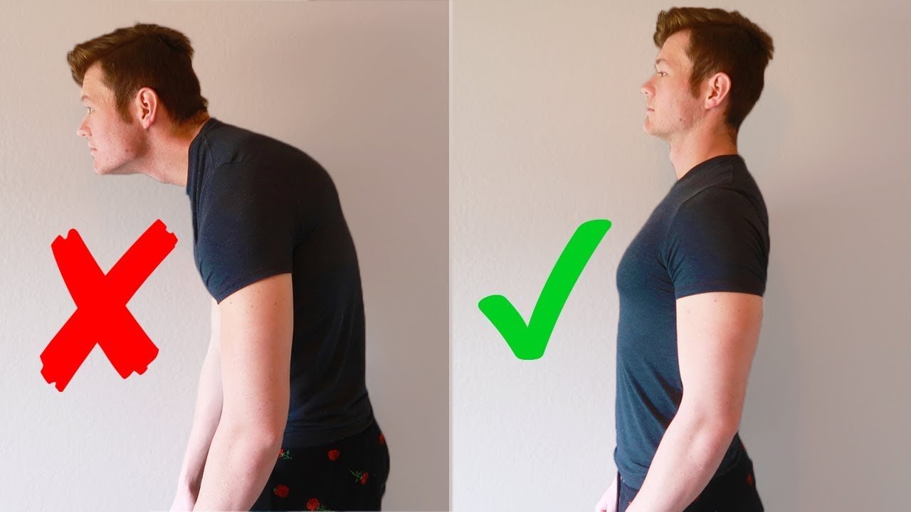 Tech Neck Exercises