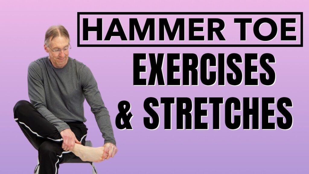 Hammer Toe Exercises