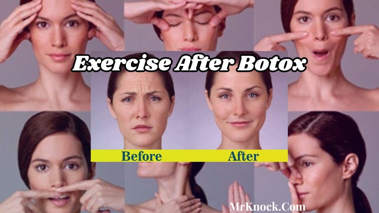 Best Exercise After Botox Guidelines and Tips for Safety